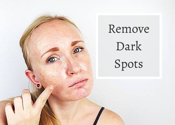 How To Remove Dark Spots On The Face The Wikipedia Of Cleaning
