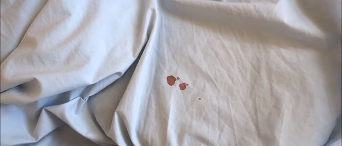 how to remove blood from white sheets (1)